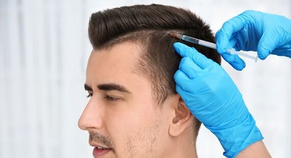 Hair Transplant in Delhi Hair Transplant in Delhi