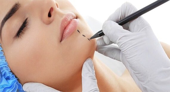 Chin Augmentation in Delhi Chin Augmentation in Delhi