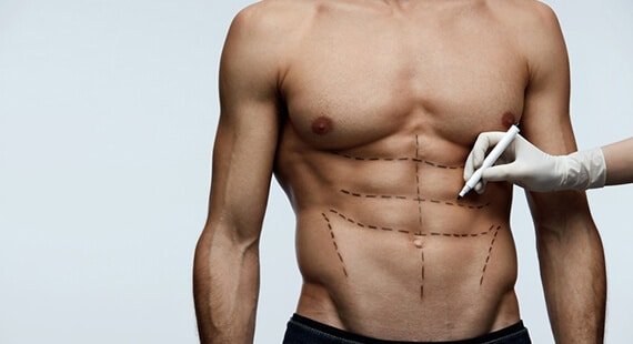 Six pack abs surgery cost in india Six pack abs surgery cost in india