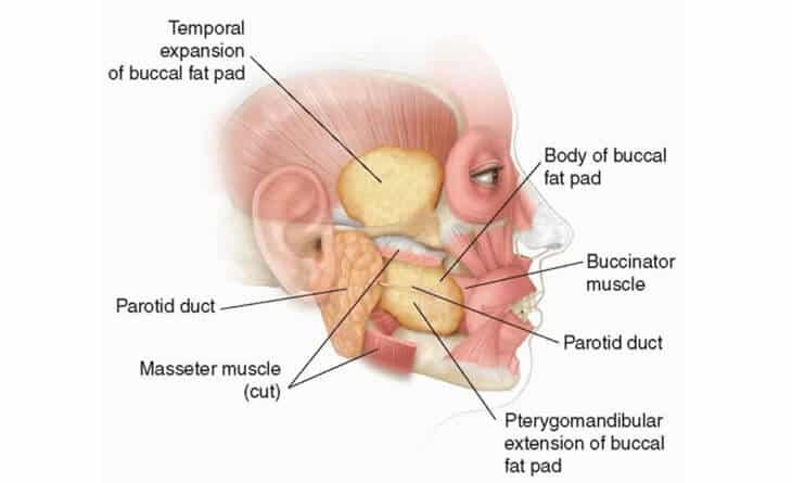Buccal Pad Fat Removal Procedure Buccal Pad Fat Removal Procedure