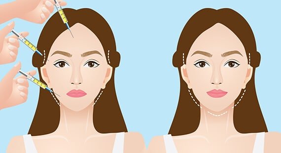 Facial Fat Grafting Facial Fat Grafting