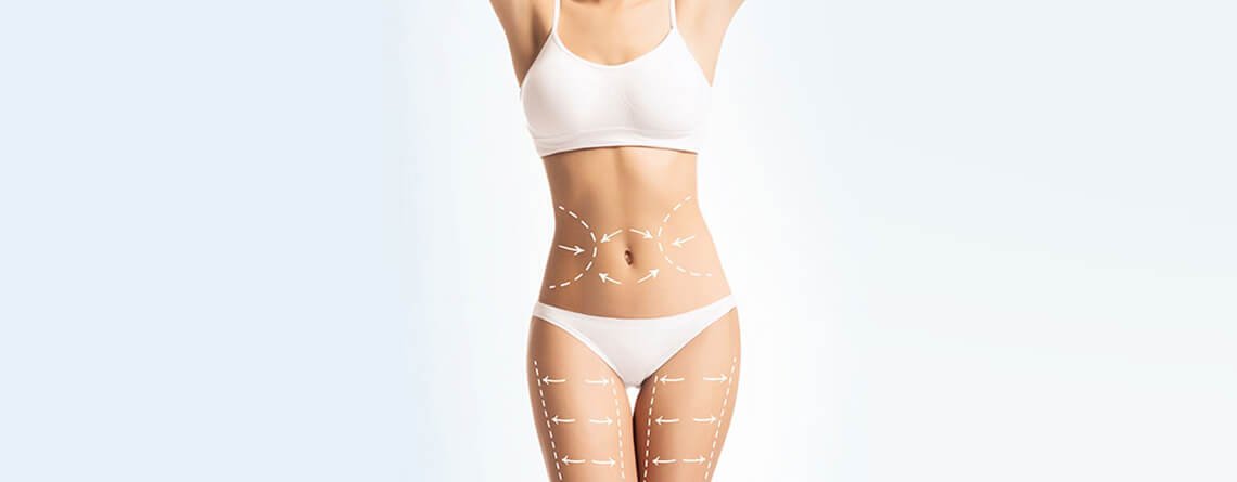 Liposuction Surgery Procedure Liposuction Surgery Procedure