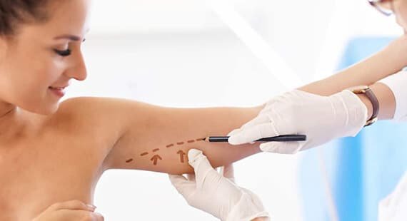 Arm Lift Surgery in Delhi Arm Lift Surgery in Delhi