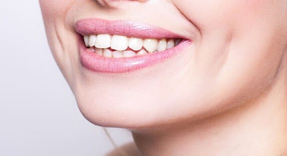 Risk involved in Dimple Creation -898