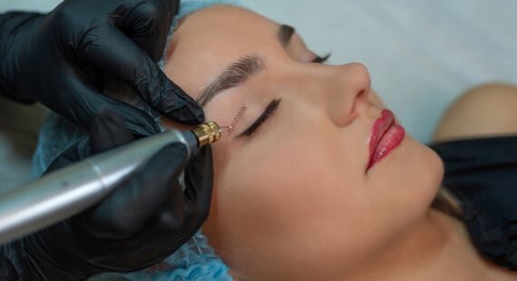 Asian Blepharoplasty in Delhi Asian Blepharoplasty in Delhi