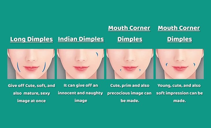 Dimple Creation Surgery Procedure Dimple Creation Surgery Procedure