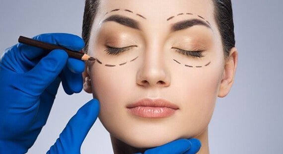 Asian Blepharoplasty in Delhi Asian Blepharoplasty in Delhi