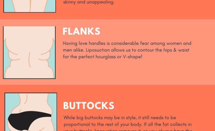 Liposuction Infographic Dr Rajat Gupta (1) Liposuction surgery