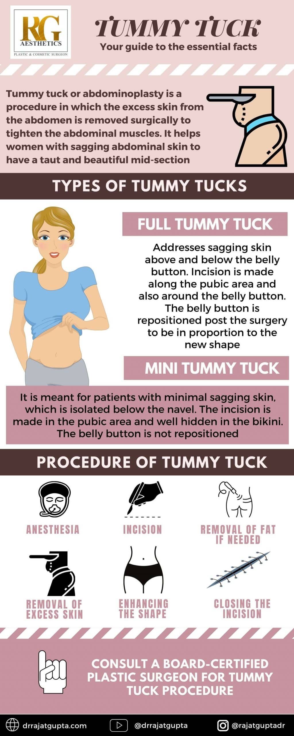 Tummy Tuck - Dr Rajat Gupta -01 (1)
