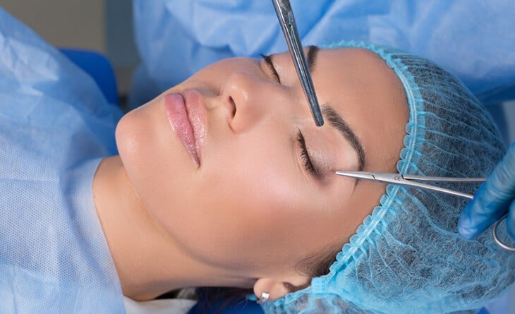 Blepharoplasty in Delhi - Dr Rajat Gupta -01 Blepharoplasty in Delhi