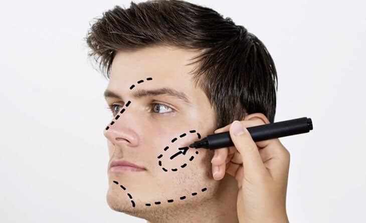 cosmetic surgery - dr rajat gupta -79 (1) plastic surgeon