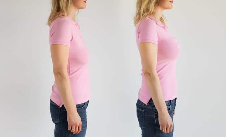 Breast Lift - Dr Rajat Gupta - 03 breast lift procedure