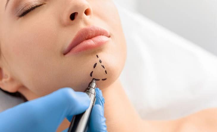 chin augmentation surgery in delhi chin augmentation surgery in delhi