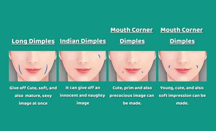 Dimple Creation Surgery - Dr Rajat Gupta - Plastic Surgeon in Delhi -01 Dimple Creation Surgery