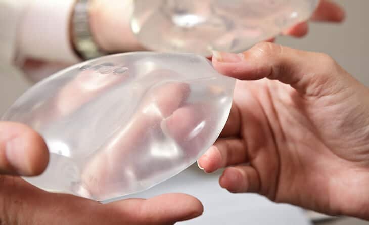 breast implants - dr rajat gupta - plastic surgeon in delhi -04 breast implants in delhi