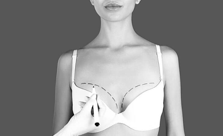 Breast Lift without breast implants price - Dr Rajat Gupta - Plastic Surgeon in Delhi - 11 Breast Lift surgery in delhi