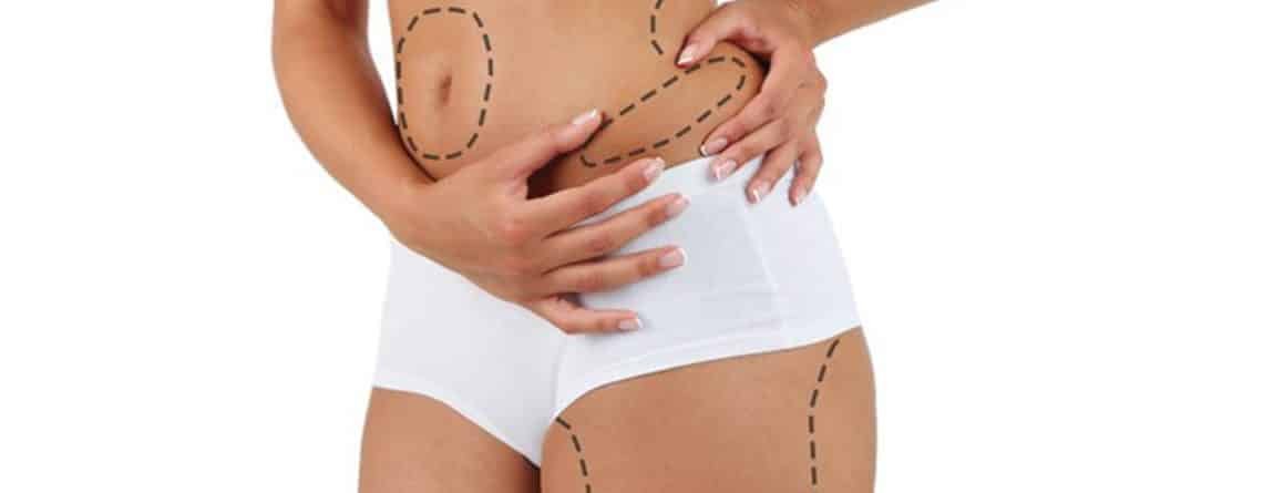 Liposuction Procedure