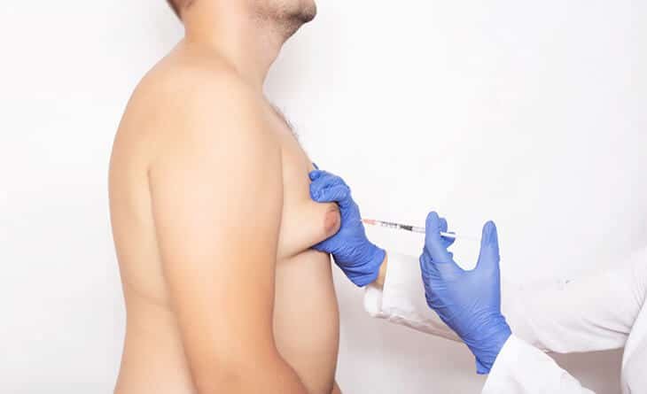 How Much Glandular Gynecomastia Surgery Costs - Dr Rajat Gupta - 02 gynecomastia surgery in delhi