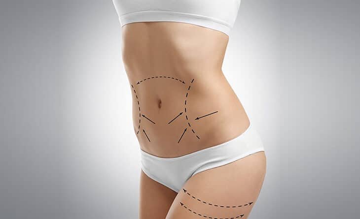 How Long Does the Mini Tummy Tuck Recovery Swelling Last - Dr Rajat Gupta -01 Mini Tummy Tuck Surgery in Delhi