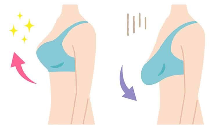 Is a Perfect Breast Lift Possible with Fillers - Dr Rajat Gupta - Plastic Surgeon in Delhi -02 Breast Lift