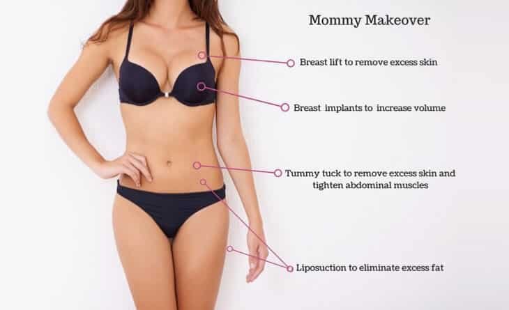 Complete Guide to Mommy Makeover - Dr Rajat Gupta - Plastic Surgeon in Delhi -012 mommy makeover surgery in India
