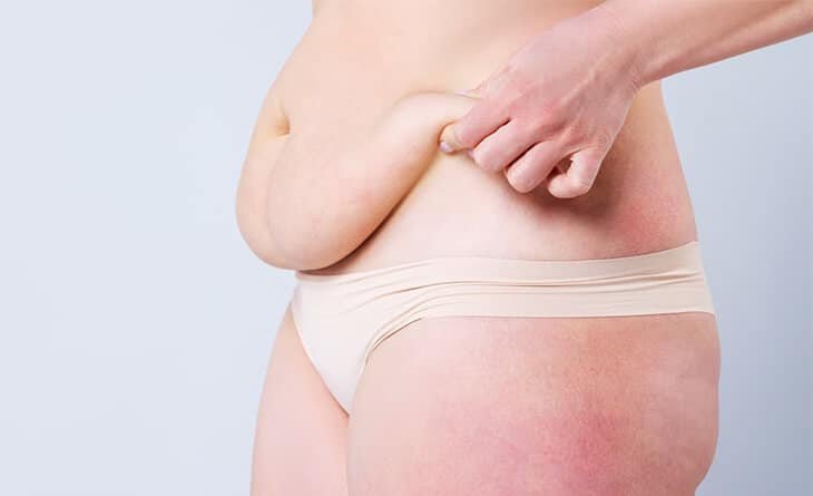 Ultimate Guide for Abdominoplasty - Dr Rajat Gupta - Plastic Surgeon in Delhi -012 Abdominoplasty - Dr Rajat Gupta - Plastic Surgeon in Delhi -012