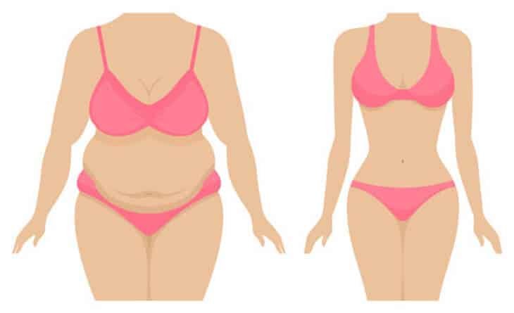 Does non surgical liposuction work - Dr Rajat Gupta - Best Plastic Surgeon in Delhi -02 Liposuction Surgery in Delhi