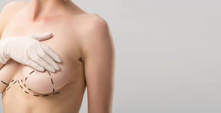 Breast Lift Procedure
