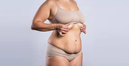 Tummy Tuck Procedure