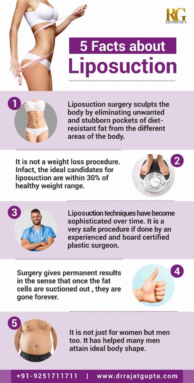 Liposuction Facts - Liposuction Surgery - Liposuction Procedure - Dr Rajat Gupta _ RG Aesthetics Liposuction Facts - Liposuction Surgery - Liposuction Procedure - Dr Rajat Gupta _ RG Aesthetics