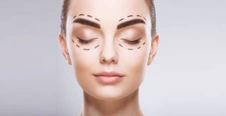 Blepharoplasty Surgery Procedure