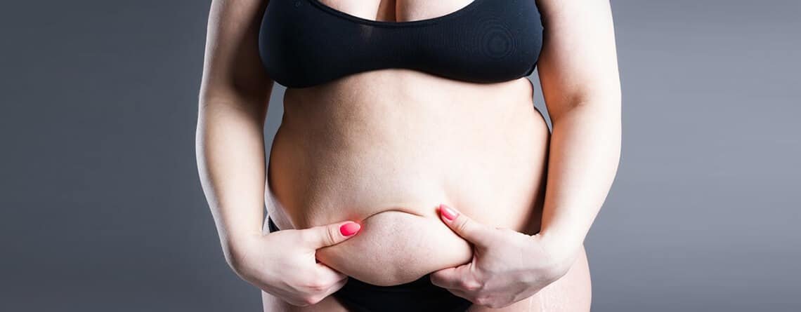 Tummy Tuck Procedure