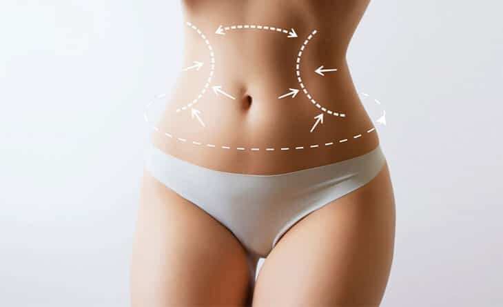 What is 360 Liposculpture - Dr Rajat Gupta - Best Plastic Surgeon in Delhi -01 Liposuction procedure