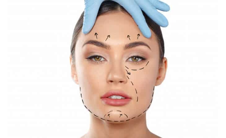 Facelift Recovery Day by Day - Dr Rajat Gupta - Best Plastic Surgeon in Delhi -02 Facelift Surgery Procedure