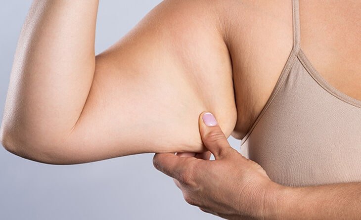 Complete Guide to Brachioplasty - Arm lift - Dr Rajat Gupta - RG Aesthetics 01
