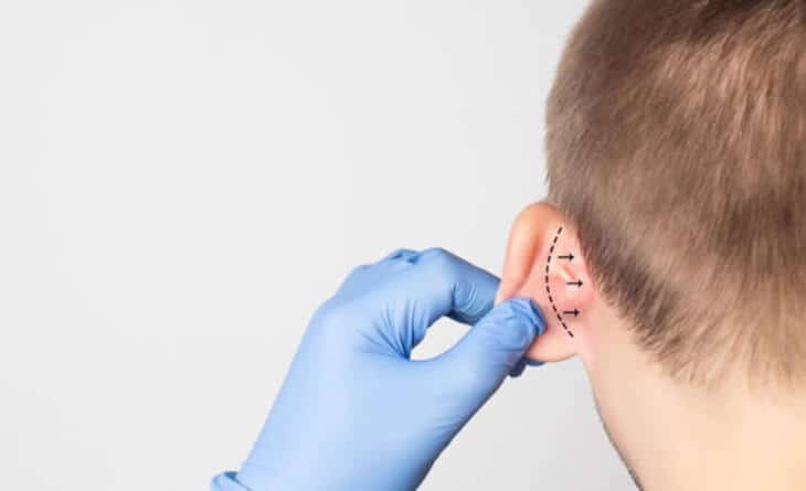 Ear reconstruction surgery in Delhi - Dr Rajat Gupta - Best Plastic Surgeon in Delhi -01 Ear reconstruction surgery in Delhi