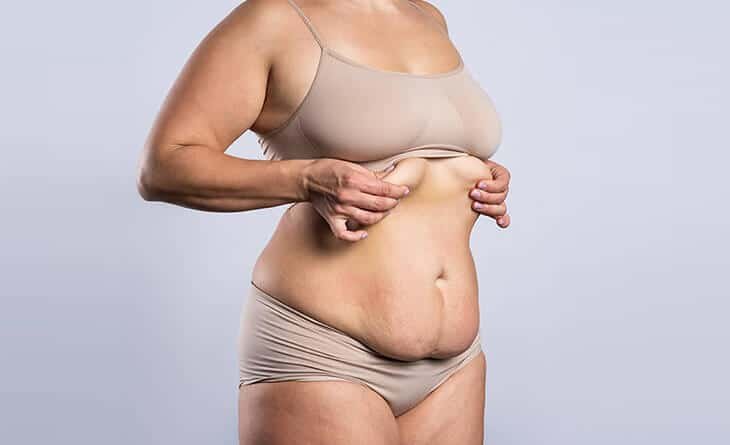 How Is A Tummy Tuck Done Step By Step - Dr Rajat Gupta - Plastic Surgeon in Delhi - RG Aesthetics 02 Tummy tuck procedure