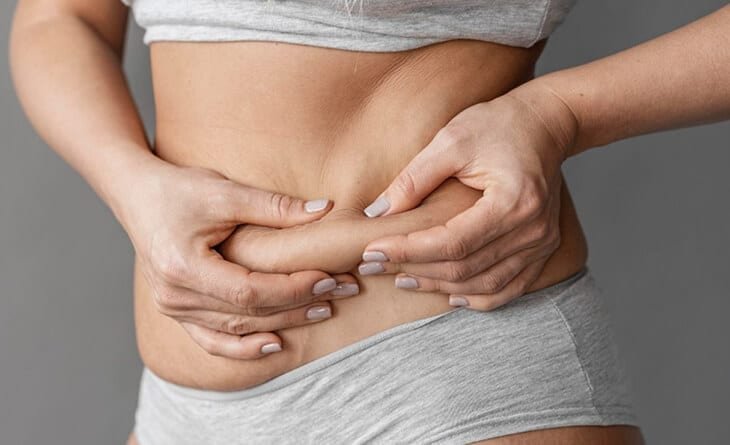 How Long Does A Tummy Tuck Procedure Take - Tummy tuck procedure - Dr Rajat Gupta - RG Aesthetics -02 Tummy tuck procedure