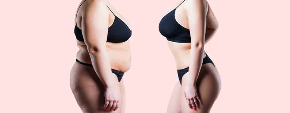 Liposuction procedure