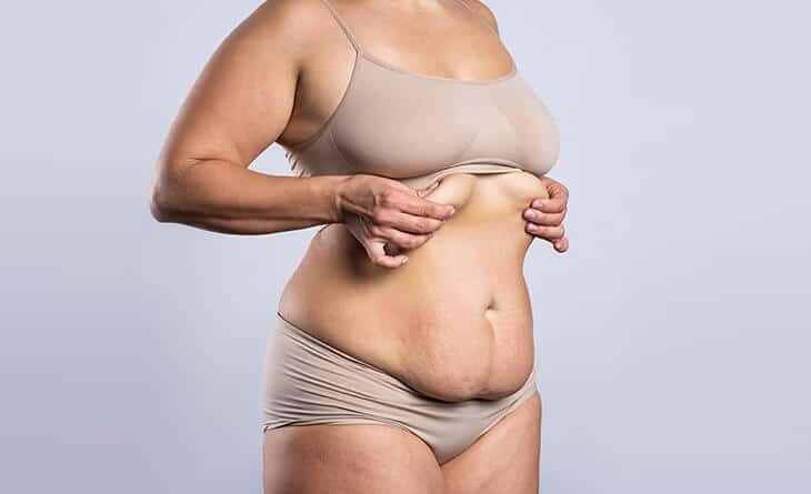 What is the Difference Between a Tummy Tuck and Abdominoplasty - Dr Rajat Gupta - Best Plastic Surgeon in Delhi -02 Abdominoplasty surgery in Delhi