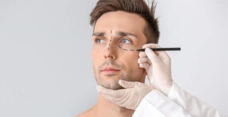 Eyelid surgery in Delhi