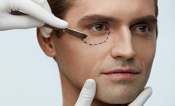 What is The Best Age to Have Eyelid Surgery - Dr Rajat Gupta - Best Plastic Surgeon in Delhi - RG Aesthetics -02 Eyelid surgery in Delhi