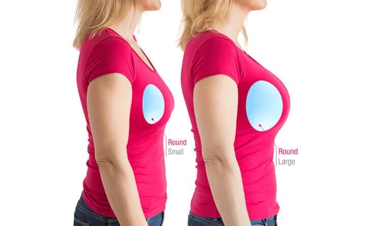 Are Smaller Breast Implants Better - Dr Rajat Gupta - Best Plastic Surgeon in Delhi - RG Aesthetics -01