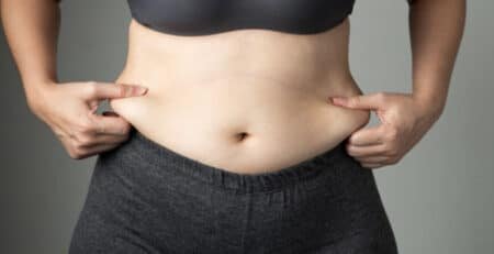 liposuction surgery