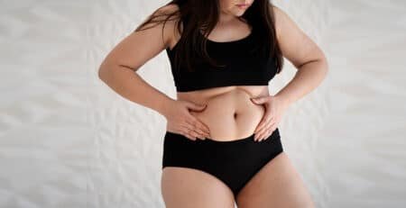 Liposuction Procedure