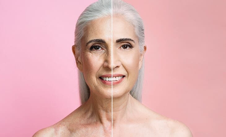 Face Lift – How It Can Make You Look Younger - Dr Rajat Gupta - Plastic Surgeon in Delhi -01 facelift surgery