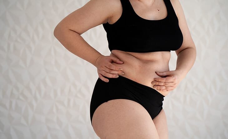 Tummy Tuck Recovery Time & Recovery Tips - Dr Rajat Gupta - RG Aesthetics -02 Tummy Tuck surgery