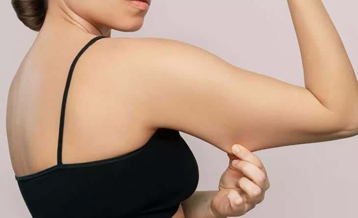 Arm Lift Surgery- Whats Involved and What Does Recovery Look Like - Dr Rajat Gupta -02 Arm Lift Surgery