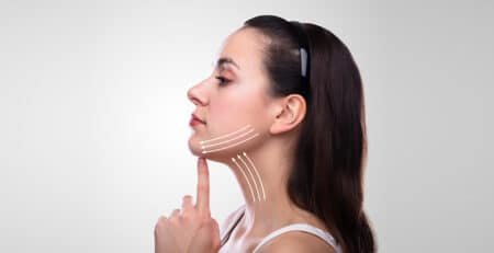 Neck Lift Surgery