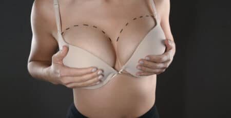 Breast Augmentation Surgery